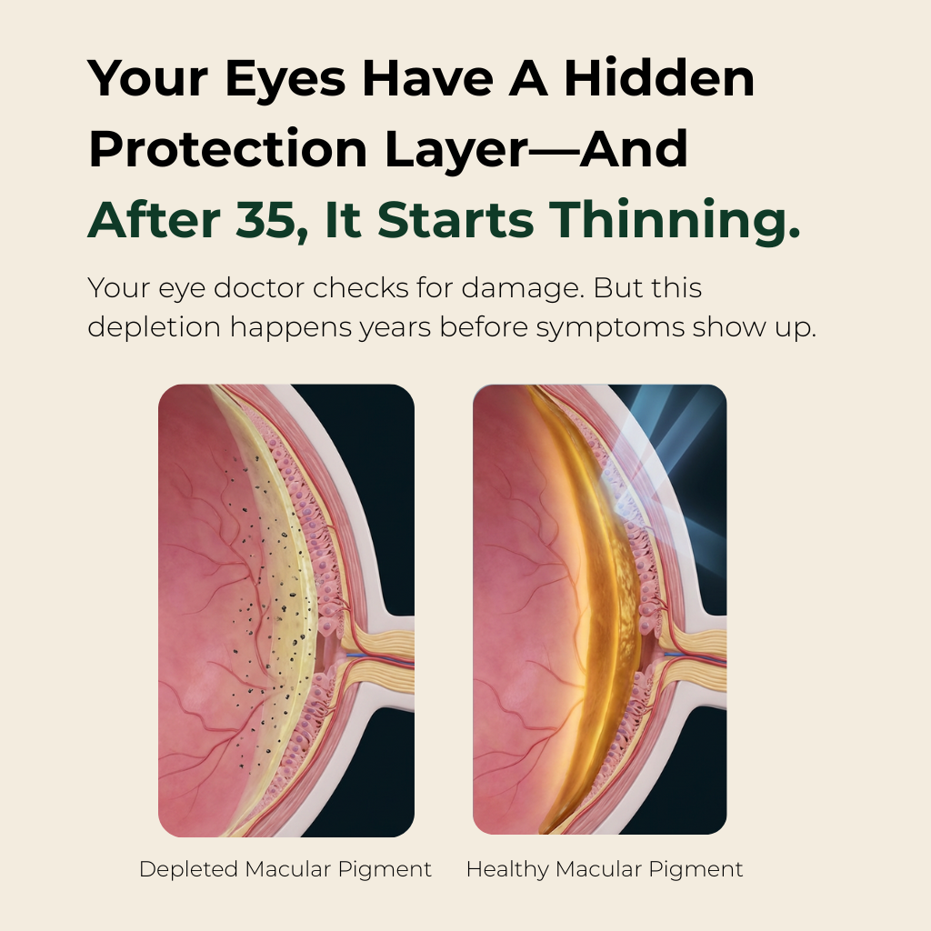 Vision Protection Complex Eye Protection Formula - Lutein Zeaxanthin Capsules by AVIV™