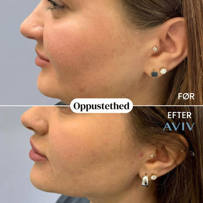 Elixir Botánico de Drenaje Linfático