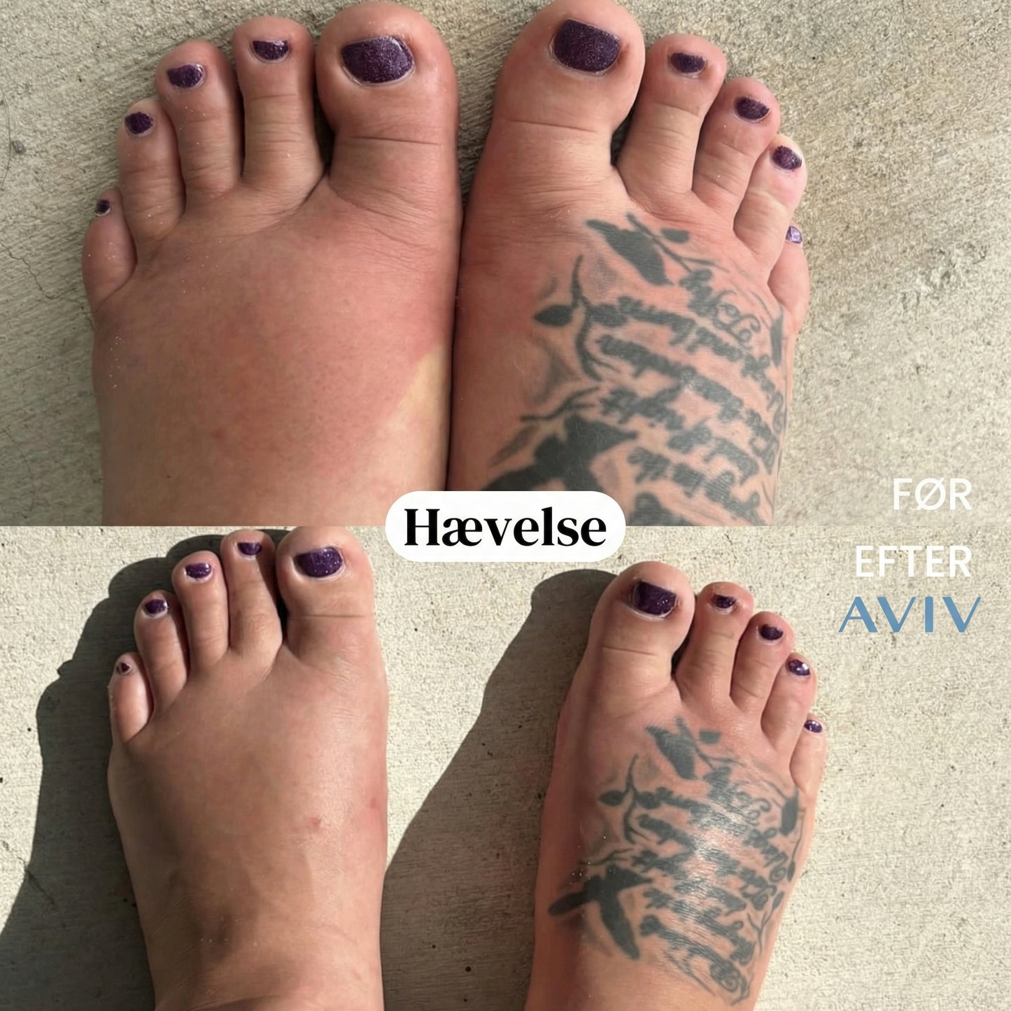 Elixir Botánico de Drenaje Linfático